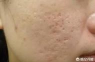 域名縮短恢復(fù) 縮小的毛衣怎么恢復(fù)正常