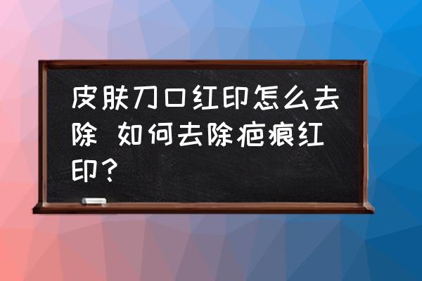 皮膚刀口紅印怎么去除 如何去除疤痕紅?。?
                                        loading=